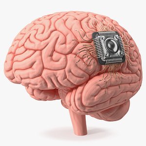 Human Brain With Implanted Microchip