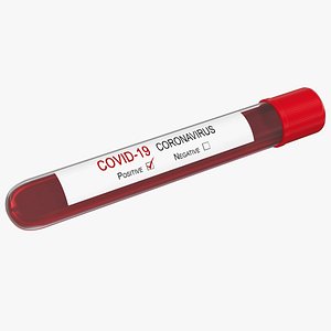 positive coronavirus covid-19 test 3D model