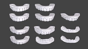 Teeth Mold - 3D Model by dcbittorf