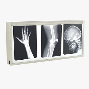 x-ray box