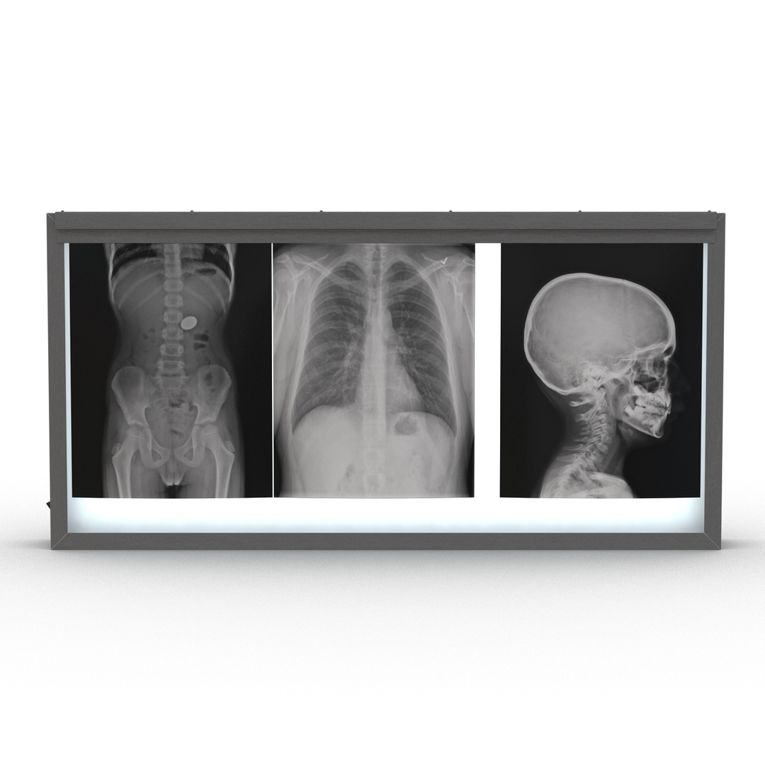 3D medical equipment 6 https://p.turbosquid.com/ts-thumb/Ol/nLmXYF/DGBkK0fL/xray_light_box_360/jpg/1595407033/1920x1080/turn_fit_q99/8fb4dc9a1c32322079fcb87f330a5f5130dbfdb7/xray_light_box_360-1.jpg