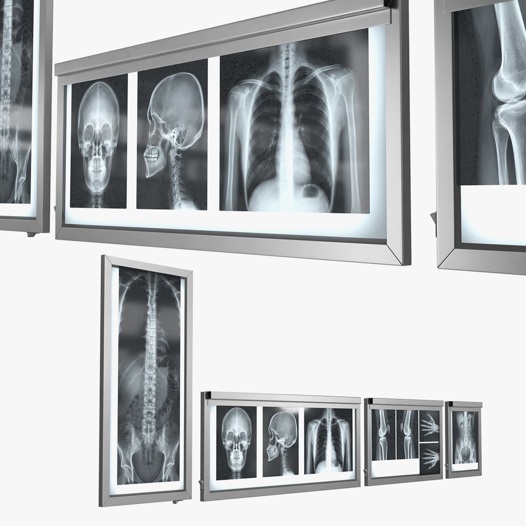 Human Body X Rays Set on Lightboxes model https://p.turbosquid.com/ts-thumb/Oo/45GxCm/14/human_body_x_rays_set_on_lightboxes_001/jpg/1786486919/1920x1080/fit_q87/437e09b45d2107c20ada8c6de488cb338f7dbc13/human_body_x_rays_set_on_lightboxes_001.jpg