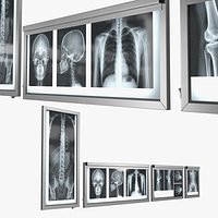 Human Body X Rays Set on Lightboxes