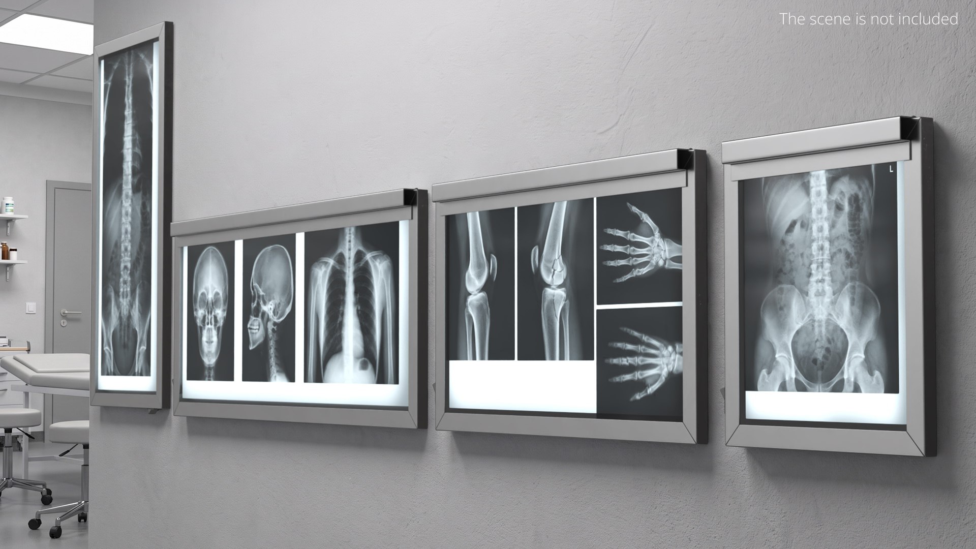 Human Body X Rays Set on Lightboxes model https://p.turbosquid.com/ts-thumb/Oo/45GxCm/79/human_body_x_rays_set_on_lightboxes_003/jpg/1786486989/1920x1080/fit_q87/7134a215765dfaadc638346633d2ca952fa58ddb/human_body_x_rays_set_on_lightboxes_003.jpg