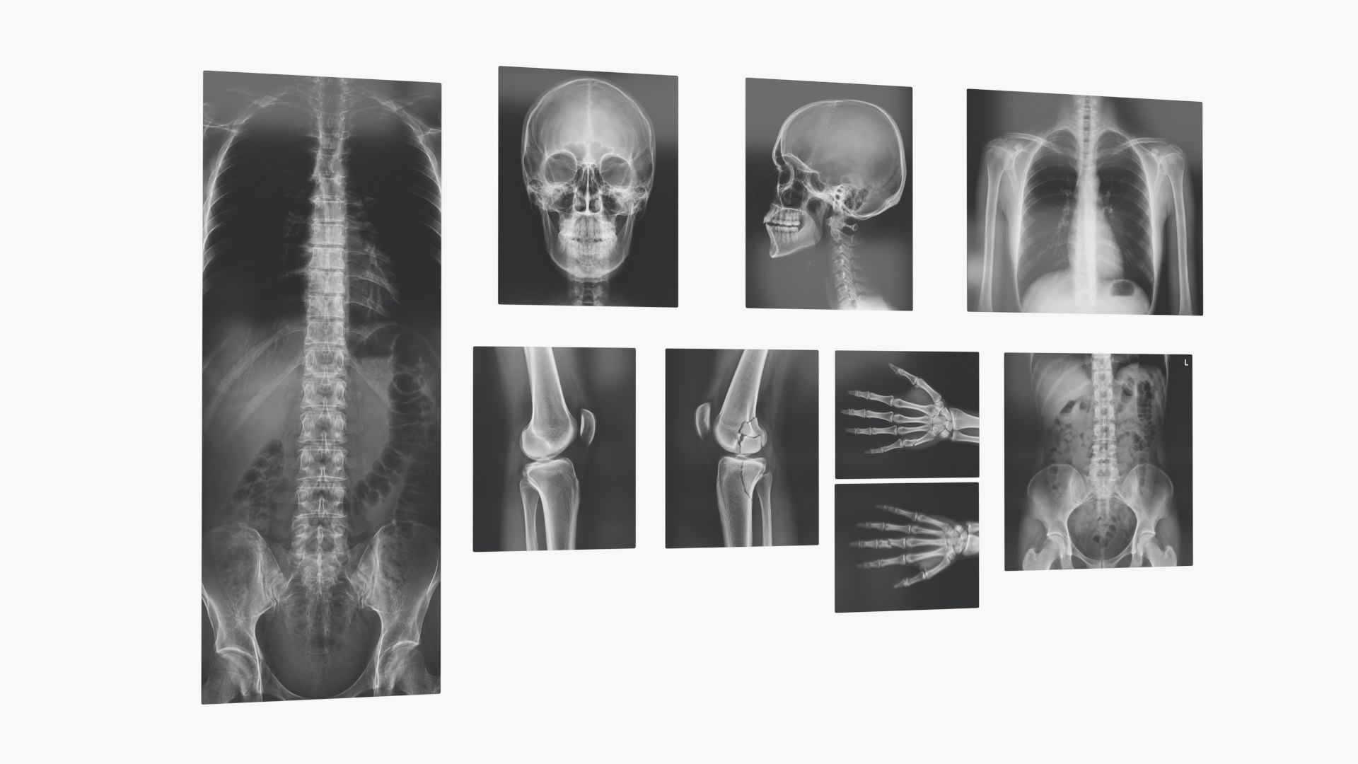 Human Body X Rays Set on Lightboxes model https://p.turbosquid.com/ts-thumb/Oo/45GxCm/By/human_body_x_rays_set_on_lightboxes_008/jpg/1786487003/1920x1080/fit_q87/80134ba4f835dc6d42a48192507b8075ed4d67b9/human_body_x_rays_set_on_lightboxes_008.jpg