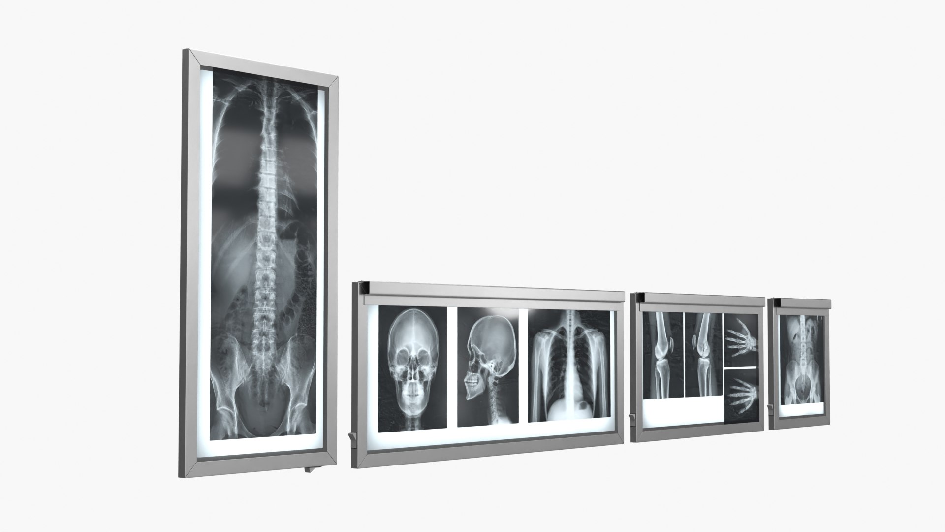 Human Body X Rays Set on Lightboxes model https://p.turbosquid.com/ts-thumb/Oo/45GxCm/KY/human_body_x_rays_set_on_lightboxes_002/jpg/1786486922/1920x1080/fit_q87/b0a59354d7939048f41e64ebb8963dd41665170d/human_body_x_rays_set_on_lightboxes_002.jpg