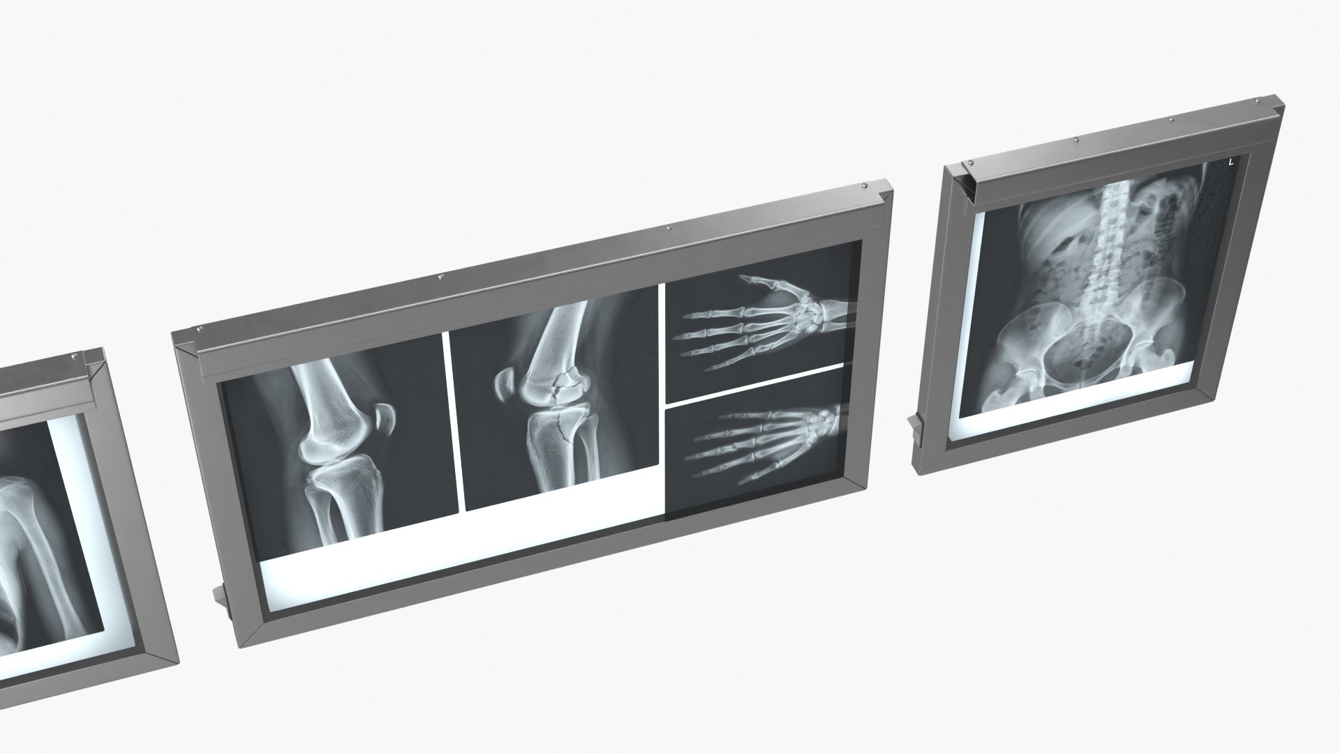 Human Body X Rays Set on Lightboxes model https://p.turbosquid.com/ts-thumb/Oo/45GxCm/Ps/human_body_x_rays_set_on_lightboxes_006/jpg/1786486997/1920x1080/fit_q87/50b8af0b38bfc4df0860710f46feffd78abea573/human_body_x_rays_set_on_lightboxes_006.jpg