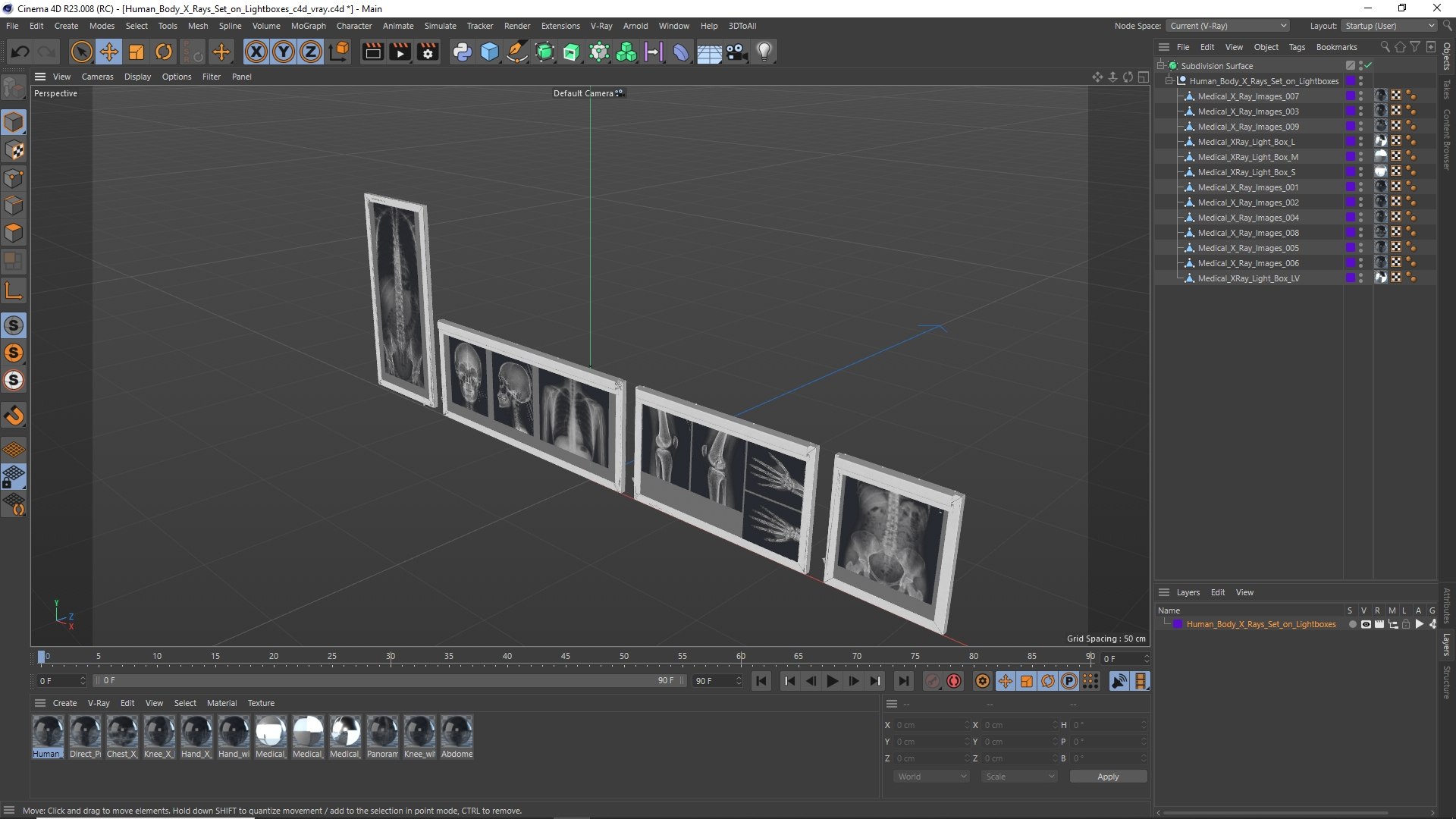 Human Body X Rays Set on Lightboxes model https://p.turbosquid.com/ts-thumb/Oo/45GxCm/Xb/human_body_x_rays_set_on_lightboxes_1003/jpg/1786487029/1920x1080/fit_q87/20fe84dea9abd85efcdb892a3adce084454bd5eb/human_body_x_rays_set_on_lightboxes_1003.jpg