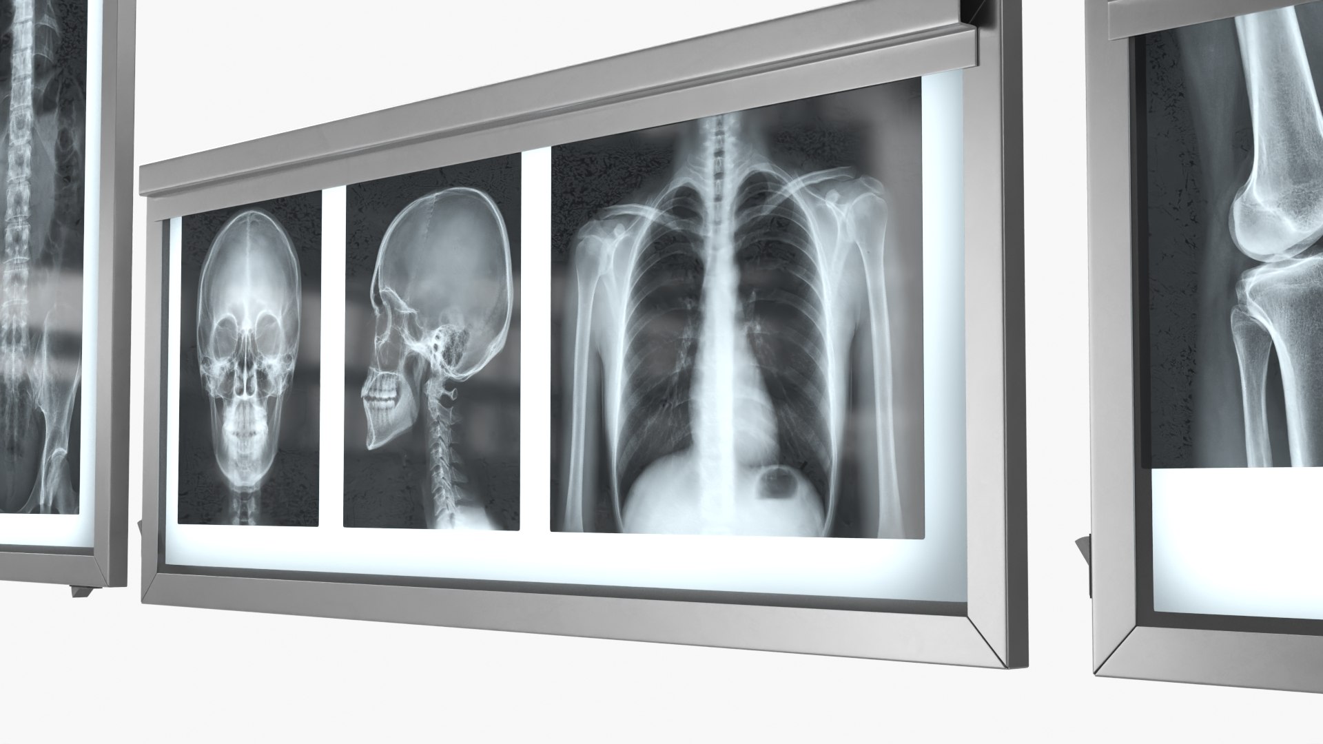 Human Body X Rays Set on Lightboxes model https://p.turbosquid.com/ts-thumb/Oo/45GxCm/Xr/human_body_x_rays_set_on_lightboxes_005/jpg/1786486995/1920x1080/fit_q87/a0ce1ec91094f50f52e9dfafcbebf8d8bf33dbe3/human_body_x_rays_set_on_lightboxes_005.jpg