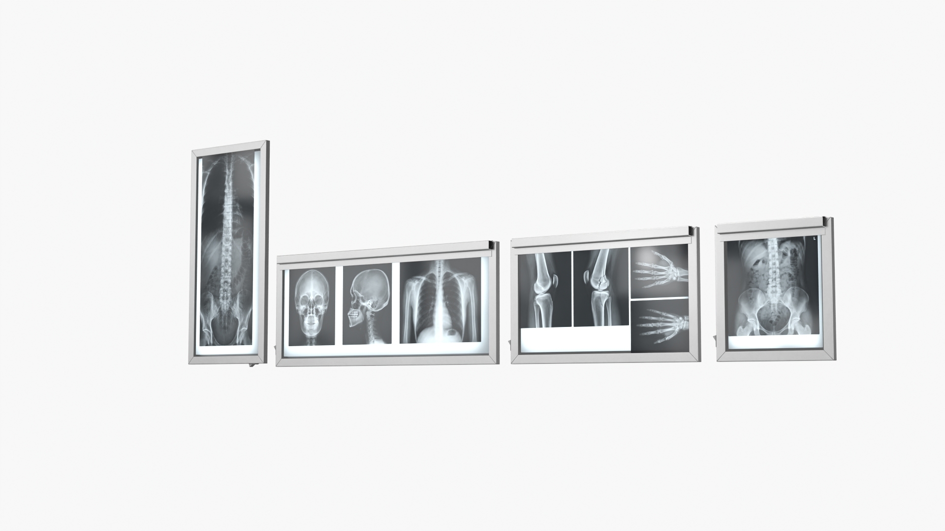 Human Body X Rays Set on Lightboxes model https://p.turbosquid.com/ts-thumb/Oo/45GxCm/jt/human_body_x_rays_set_on_lightboxes_360/jpg/1786486925/1920x1080/turn_fit_q99/70cf79ae2a95d02933100d2864921fd3753a85b7/human_body_x_rays_set_on_lightboxes_360-1.jpg