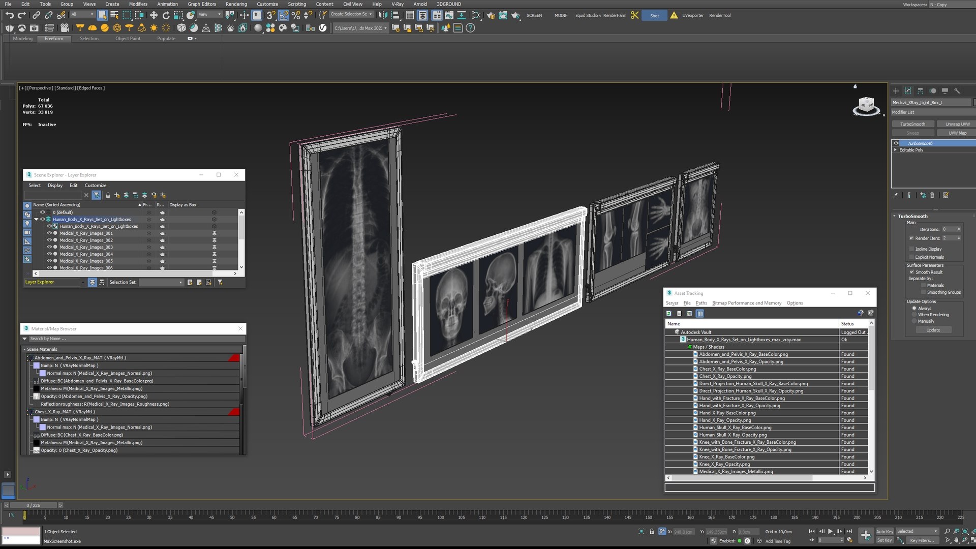 Human Body X Rays Set on Lightboxes model https://p.turbosquid.com/ts-thumb/Oo/45GxCm/lP/human_body_x_rays_set_on_lightboxes_016/jpg/1786487021/1920x1080/fit_q87/e0fdb2bbe794dde397a27ac97eaec4738a82d549/human_body_x_rays_set_on_lightboxes_016.jpg