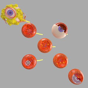 Diabetic eye diseases