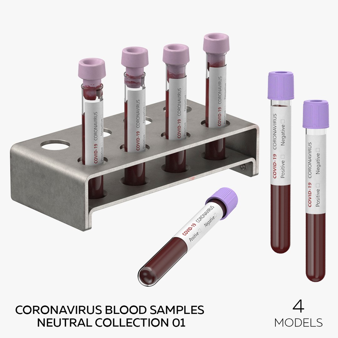 Coronavirus Blood Samples Neutral Collection 01 - 4 models 3D model https://p.turbosquid.com/ts-thumb/Ot/YD5Wz0/GS/square/jpg/1658155607/1920x1080/fit_q87/cc75d1c22cda7d89dacda3121a4dea6467163ef3/square.jpg