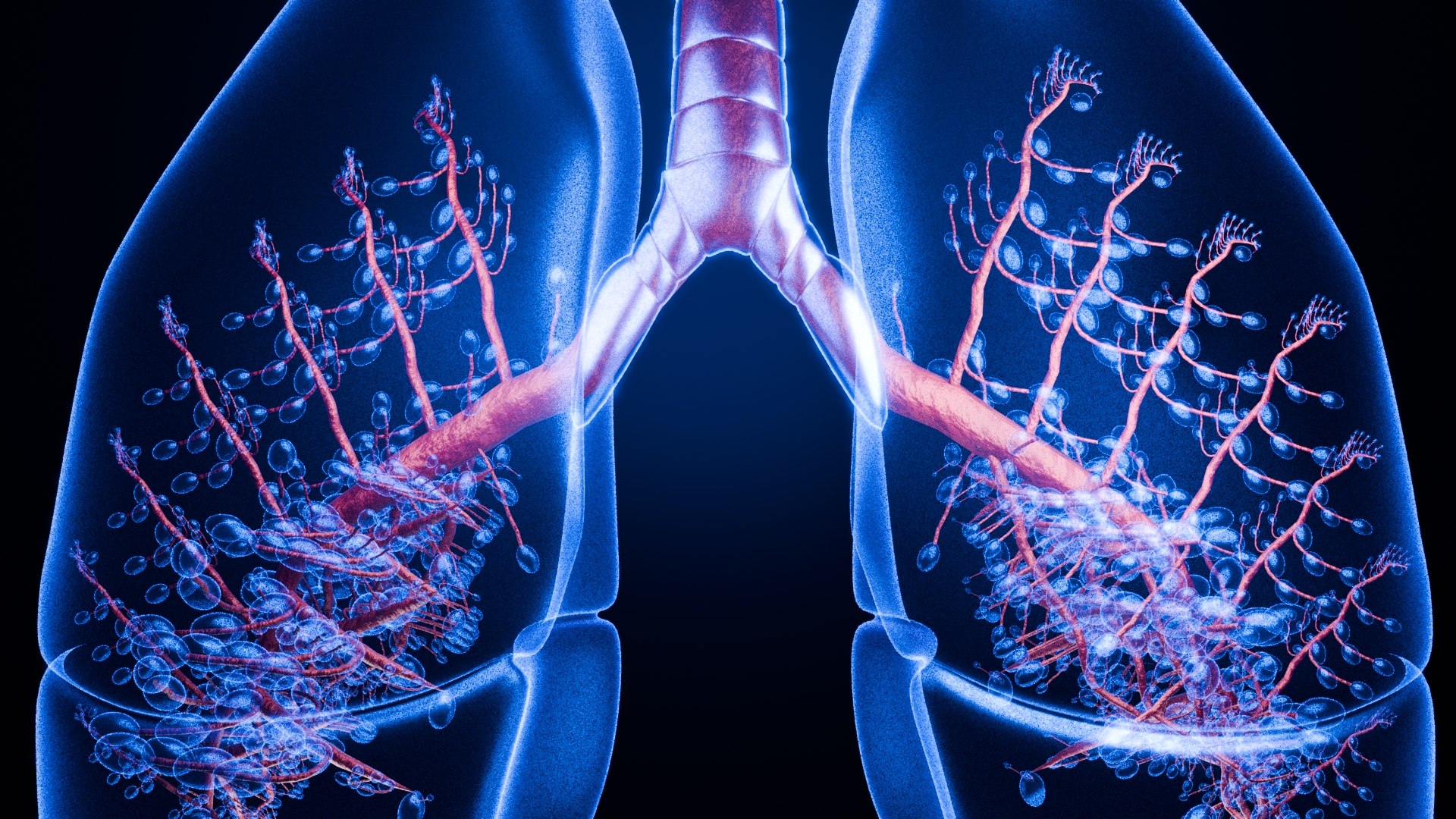 Lung Damage and Lung Cancer Progression Animation 3D model https://p.turbosquid.com/ts-thumb/PC/FKh3M5/C7/0041/jpg/1773581281/1920x1080/fit_q87/d434cda9784c86716d67c89d0012c2162097e3f5/0041.jpg