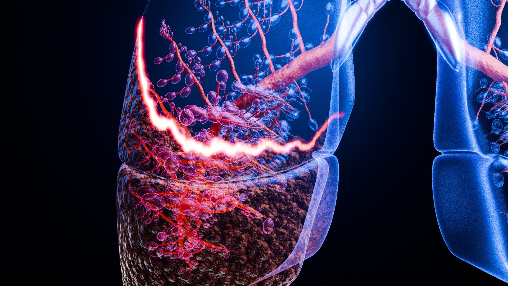Lung Damage and Lung Cancer Progression Animation 3D model https://p.turbosquid.com/ts-thumb/PC/FKh3M5/S0/0031/jpg/1773581281/1920x1080/fit_q87/540a8c6ae27d6c6da009bb2256d533307df3cec6/0031.jpg