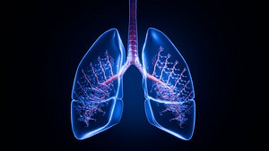 Lung Damage and Lung Cancer Progression Animation