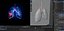 Lung Damage and Lung Cancer Progression Animation