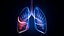 Lung Damage and Lung Cancer Progression Animation