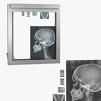 Medical X Ray Viewer with Dental and Skull Radiographs