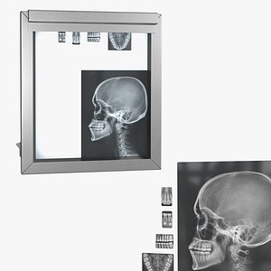 Medical X Ray Viewer with Dental and Skull Radiographs