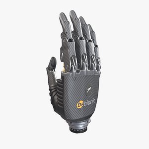 Robotic Arm Prosthesis