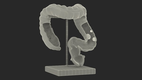 modèle 3D de Modèle médical Intestin malade - TurboSquid 2068464