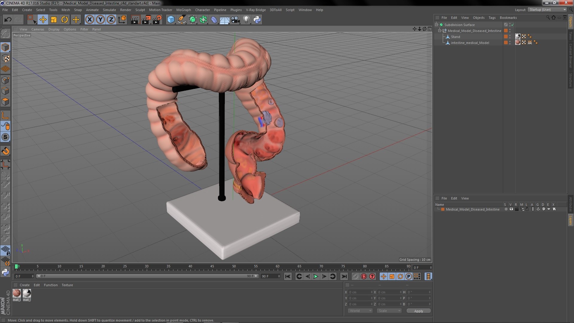 Medical Model Diseased Intestine Model - TurboSquid 2068464