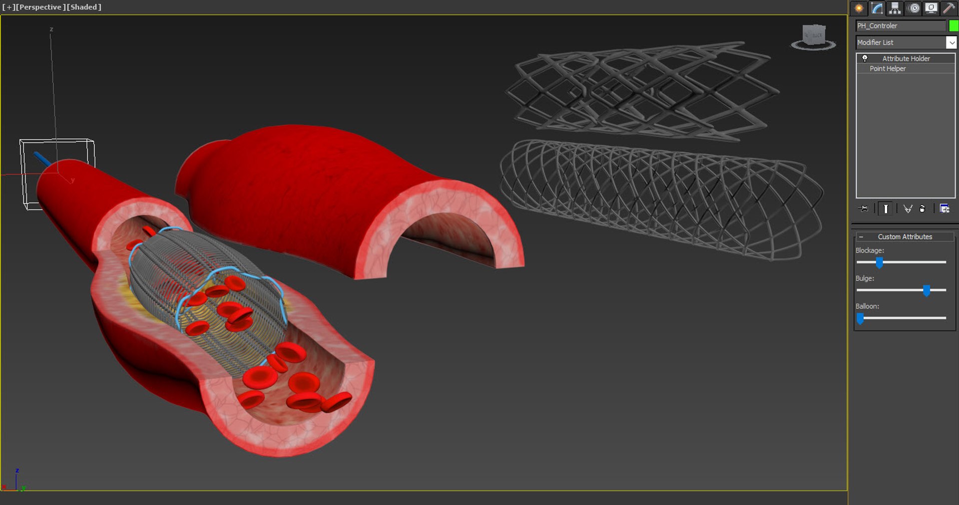3D stents artery https://p.turbosquid.com/ts-thumb/Pi/6DXgFO/9RIrCnNY/20201111/jpg/1605092106/1920x1080/fit_q87/dbaa1c36e104e9336fecac35df129a37b85dfba9/20201111.jpg