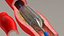 Stents com artéria