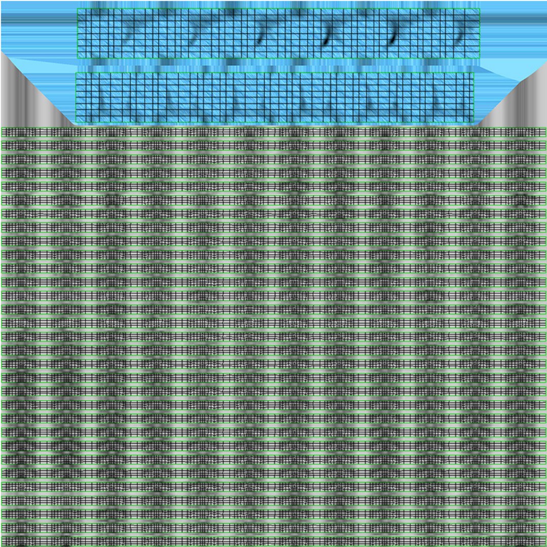 3D stents artery https://p.turbosquid.com/ts-thumb/Pi/6DXgFO/WJg8JOQZ/ultraflexuvw2/jpg/1605092106/1920x1080/fit_q87/1e29edbd00cc39b5c50ba13d9bce6802d471ec88/ultraflexuvw2.jpg