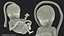 Human Fetus 16 Weeks Rigged for Maya