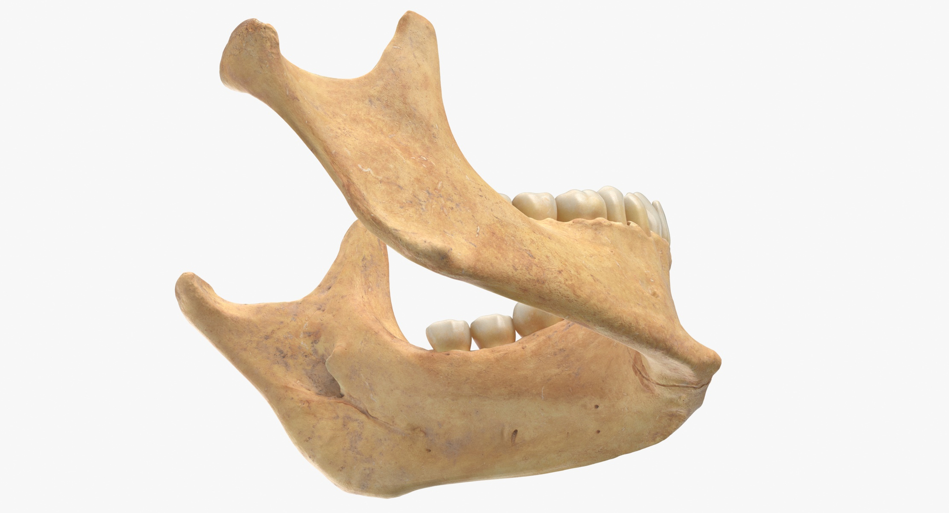 人类女性颚骨系列白色和黄色 - 2 款3D模型 - TurboSquid 1752286