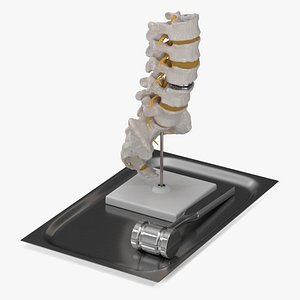 Anatomical Model of Spine with Orthopedic Mallet