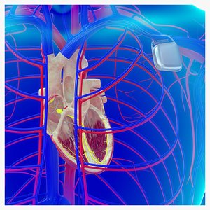 3D Heart artificial pacemaker with circulatory system model
