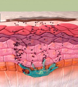 Skin Layers with Melanin