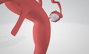 3D vigina