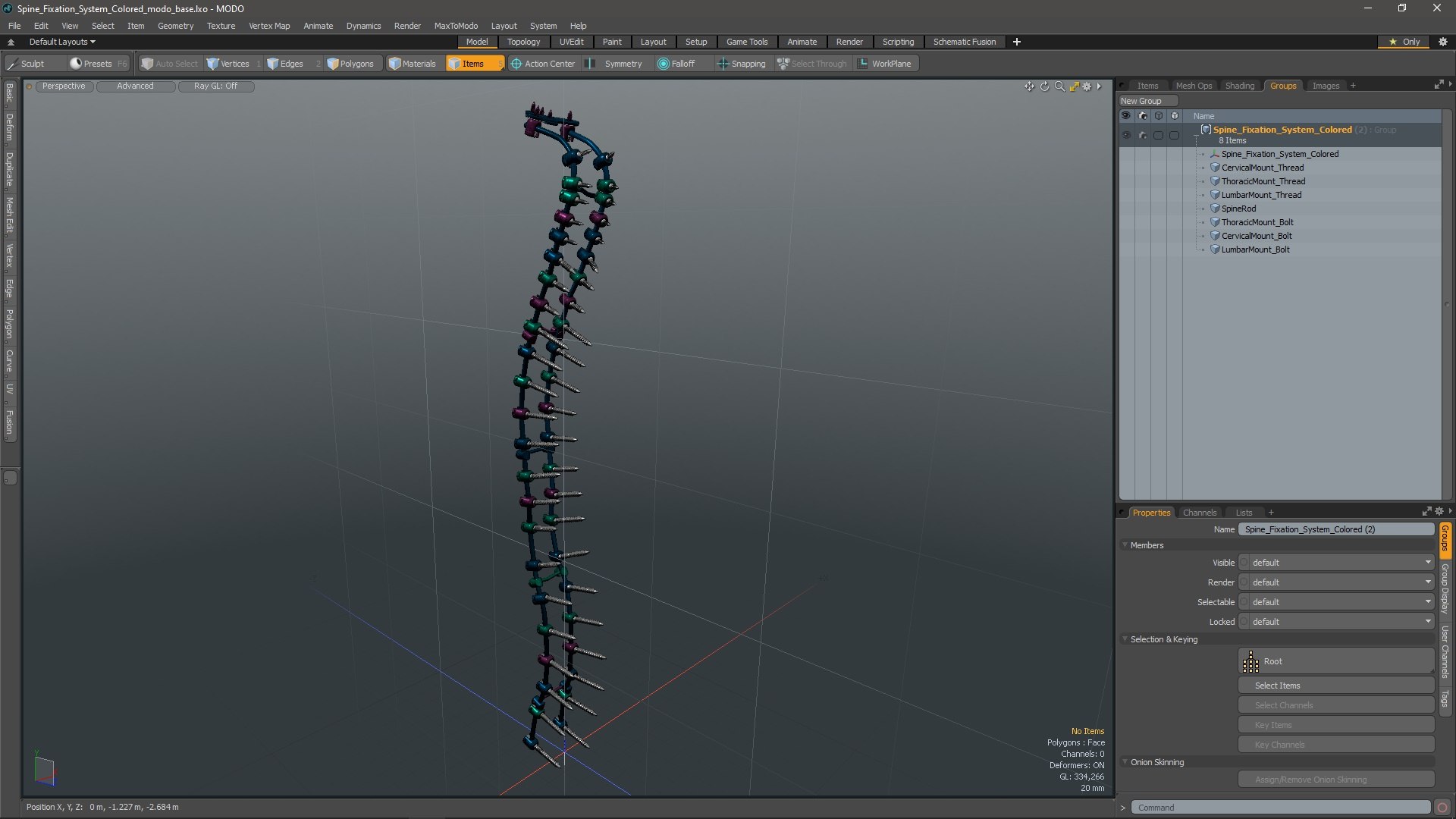 Spine Fixation System Colored 3D Model - TurboSquid 2205524