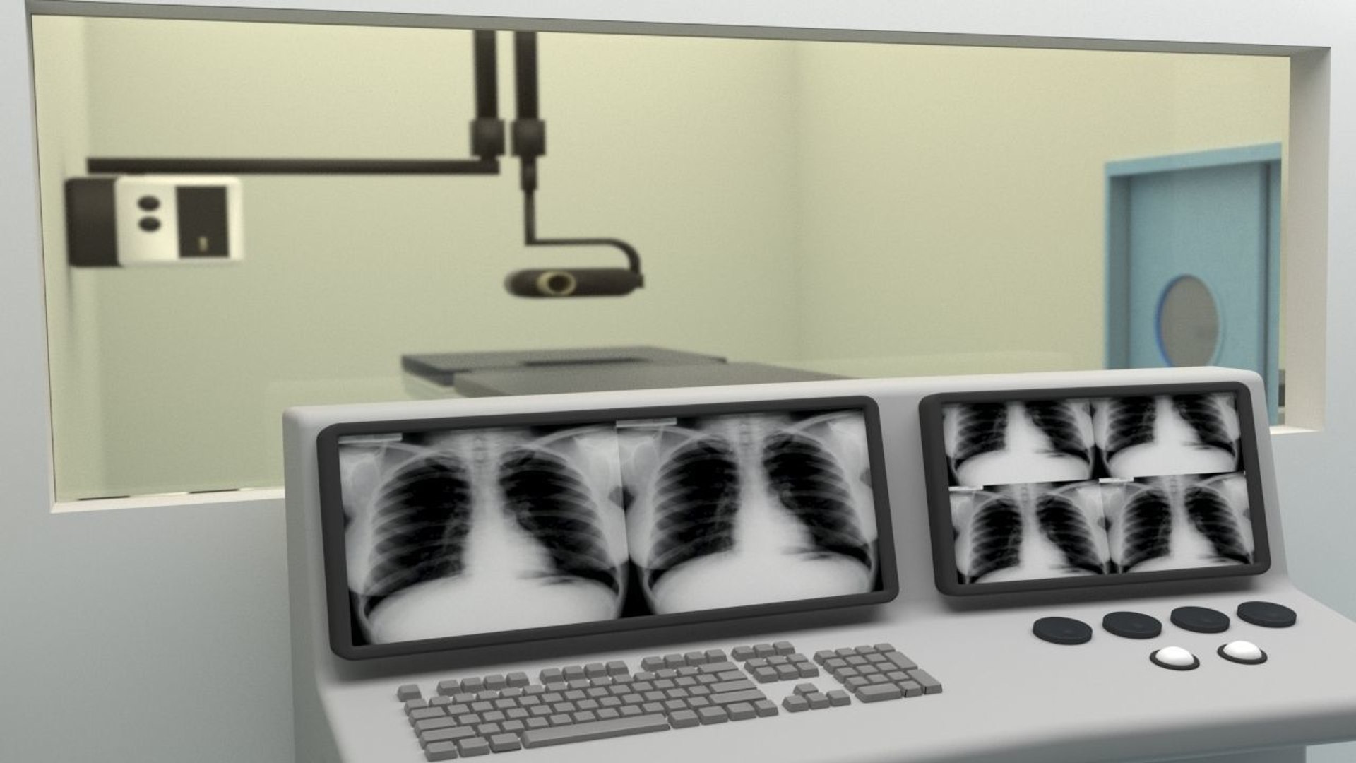 3D x-ray unit https://p.turbosquid.com/ts-thumb/QH/GkOt8e/yCtuV7gz/xrayunitrender3/jpg/1579111379/1920x1080/fit_q87/3f2dfcd6539e6b578a0080035b7060d79f140ca5/xrayunitrender3.jpg