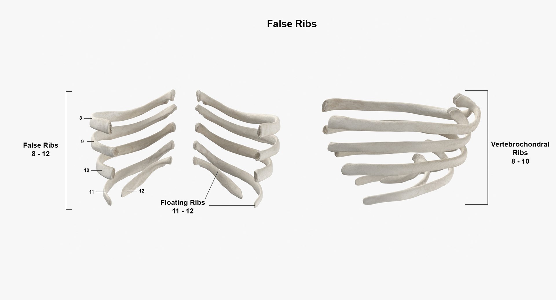3D real human rib cage - TurboSquid 1639933