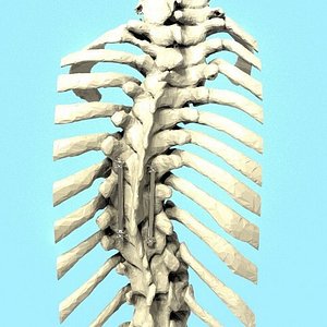 3D spine implant