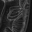 Kidney Cross Section Printable