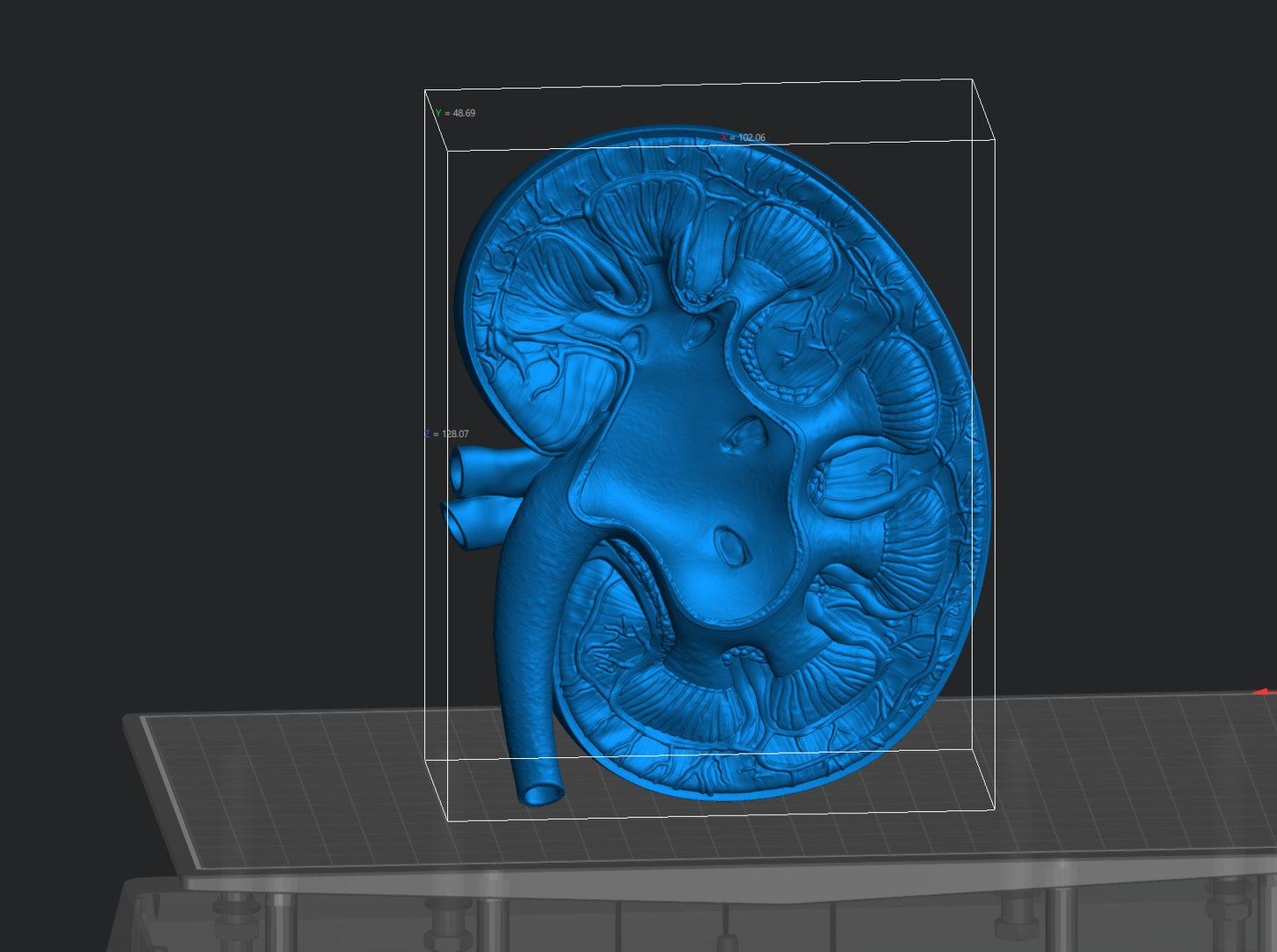 3D Kidney Cross Section Printable https://p.turbosquid.com/ts-thumb/R0/bhpt4Y/DK/screenshot_2/png/1776270305/1920x1080/fit_q87/2599ce0e838619376608e8b6133c0f9dc19b3586/screenshot_2.jpg