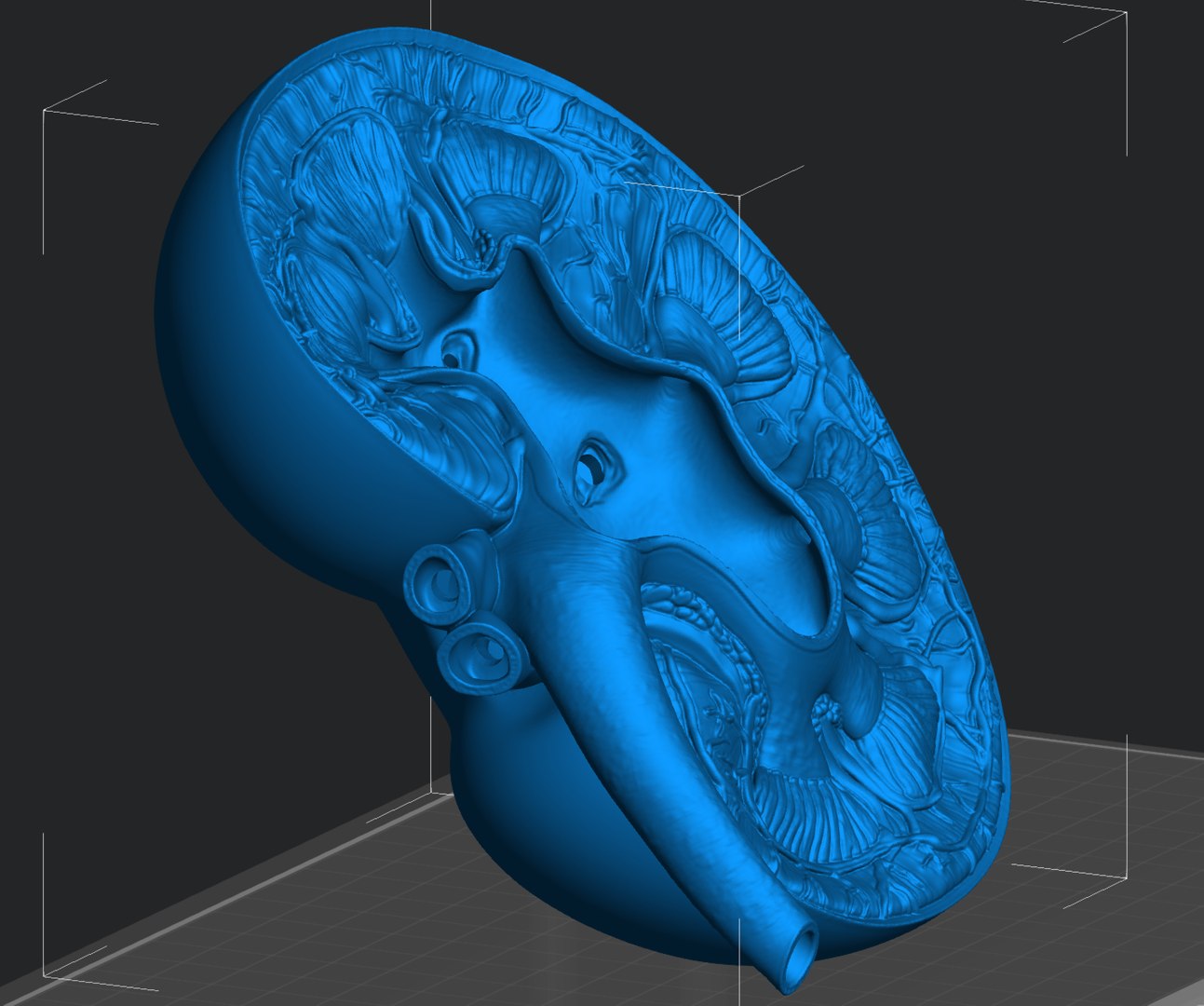 3D Kidney Cross Section Printable https://p.turbosquid.com/ts-thumb/R0/bhpt4Y/SN/screenshot_5/png/1776270308/1920x1080/fit_q87/363558e387a0e6bfe65dc3cf34ad31a066f219d3/screenshot_5.jpg