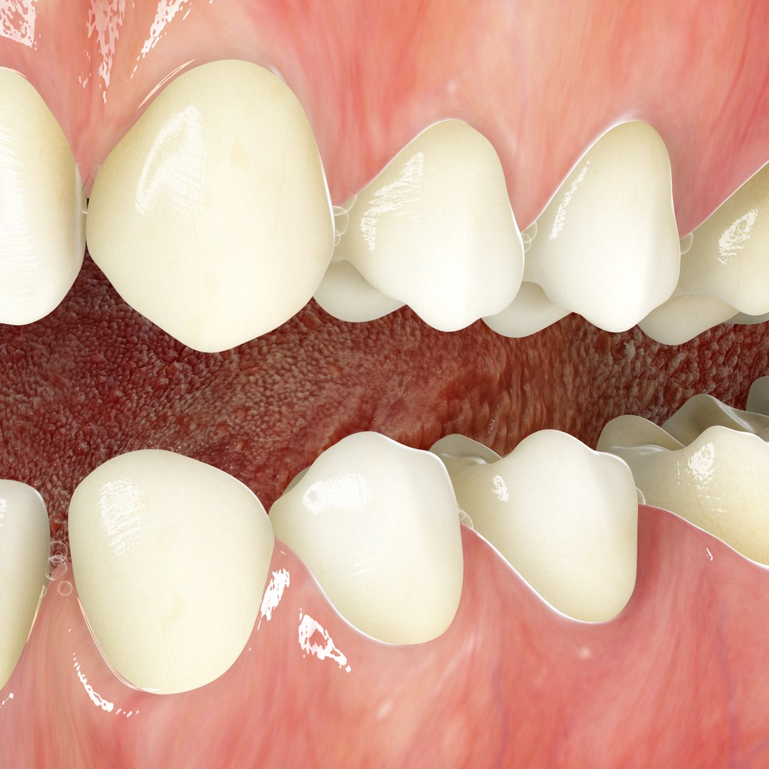 realistic teeth gums tongue max https://p.turbosquid.com/ts-thumb/R1/2M8Vpy/uavT7cAT/closeup_01/jpg/1401745689/1920x1080/fit_q87/f4ba2cd4ead808b372e6505193059fc021f1a85e/closeup_01.jpg