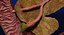 Hepato biliary tract pancreas gallbladder