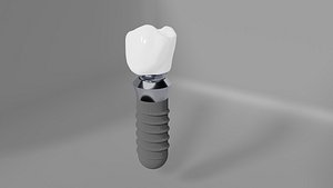 Dental implant and crown