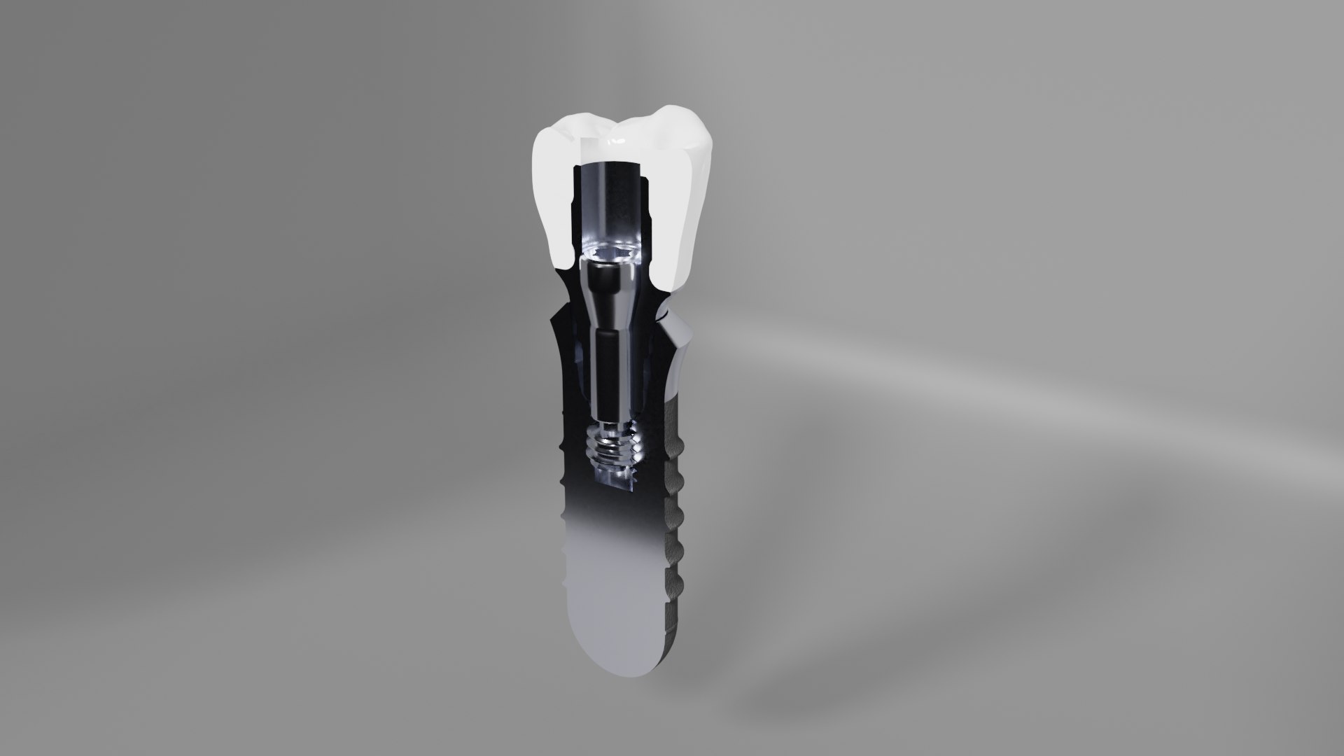 implant crown dental 3D https://p.turbosquid.com/ts-thumb/R6/IByHqo/iz/untitled3/png/1615378814/1920x1080/fit_q87/287d0cb12c18979a27fa154c98557d86933954c5/untitled3.jpg