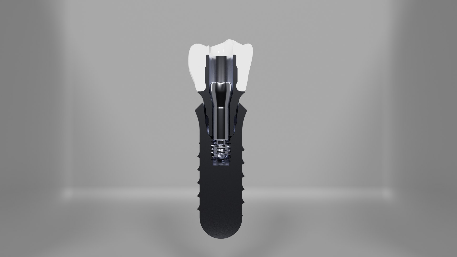implant crown dental 3D https://p.turbosquid.com/ts-thumb/R6/IByHqo/xS/untitled2/png/1615378774/1920x1080/fit_q87/bb2d575fc8a91d054093771b981b9392251f8947/untitled2.jpg