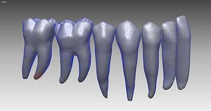 3D Mandible Teeth Surface model