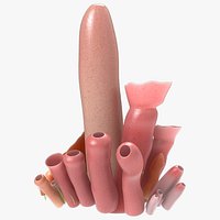 Enlargement of collar cells sponges